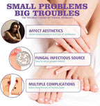 Jaysuin - Nail Fungus Spray