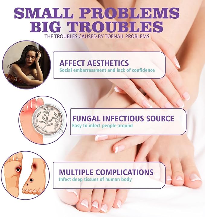 Jaysuin - Nail Fungus Spray