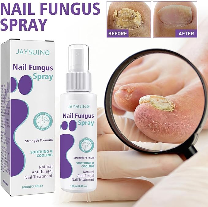 Jaysuin - Nail Fungus Spray