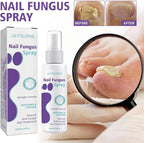 Jaysuin - Nail Fungus Spray
