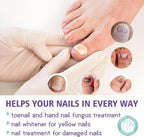 Jaysuin - Nail Fungus Spray
