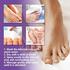 Jaysuin - Nail Fungus Spray